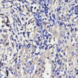 Anti-ANGPT2 Antibody from Bioworld Technology (BS6063) - Antibodies.com