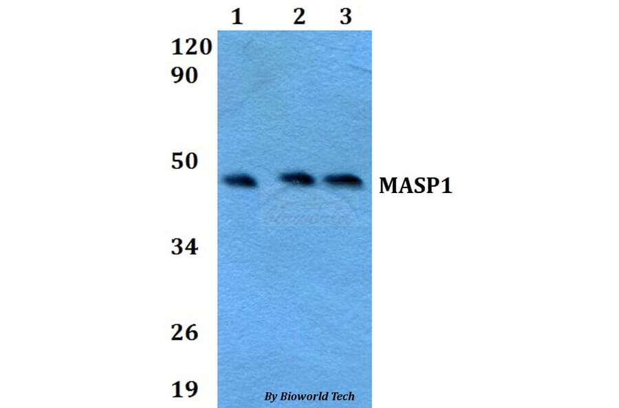 Anti-MASP1 Antibody from Bioworld Technology (BS60635) - Antibodies.com