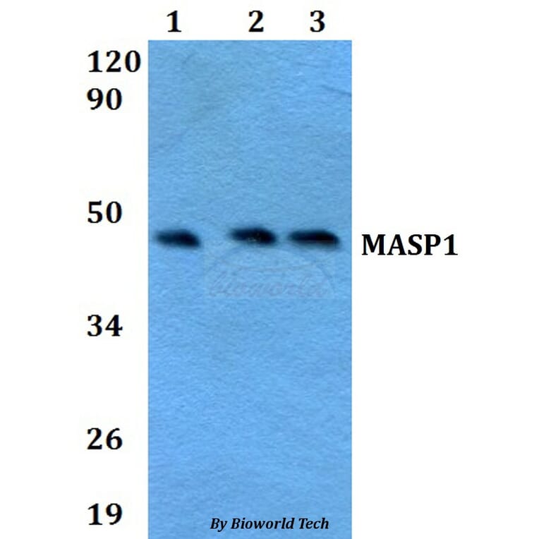 Anti-MASP1 Antibody from Bioworld Technology (BS60635) - Antibodies.com