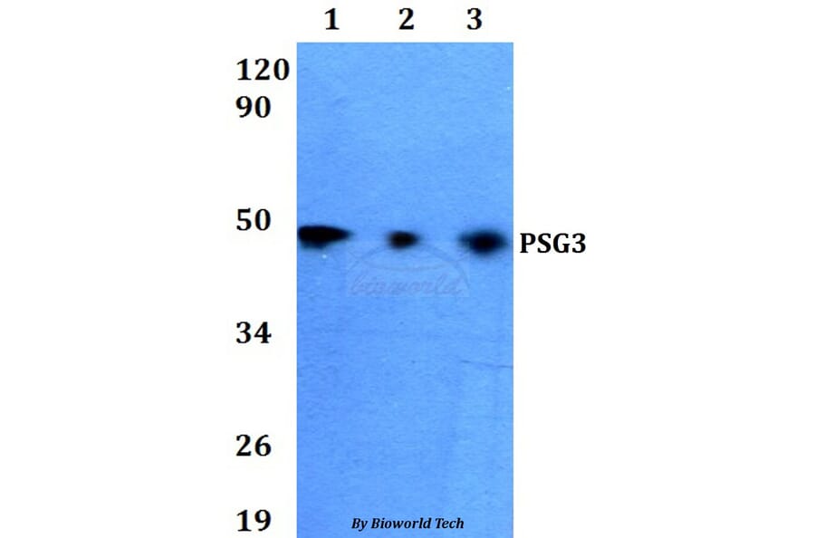 Anti-PSG3 Antibody from Bioworld Technology (BS60638) - Antibodies.com