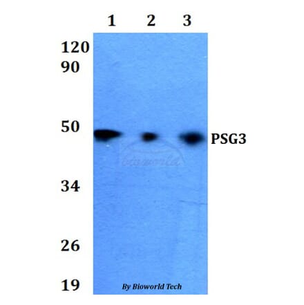 Anti-PSG3 Antibody from Bioworld Technology (BS60638) - Antibodies.com