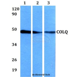 Anti-COLQ Antibody from Bioworld Technology (BS60639) - Antibodies.com