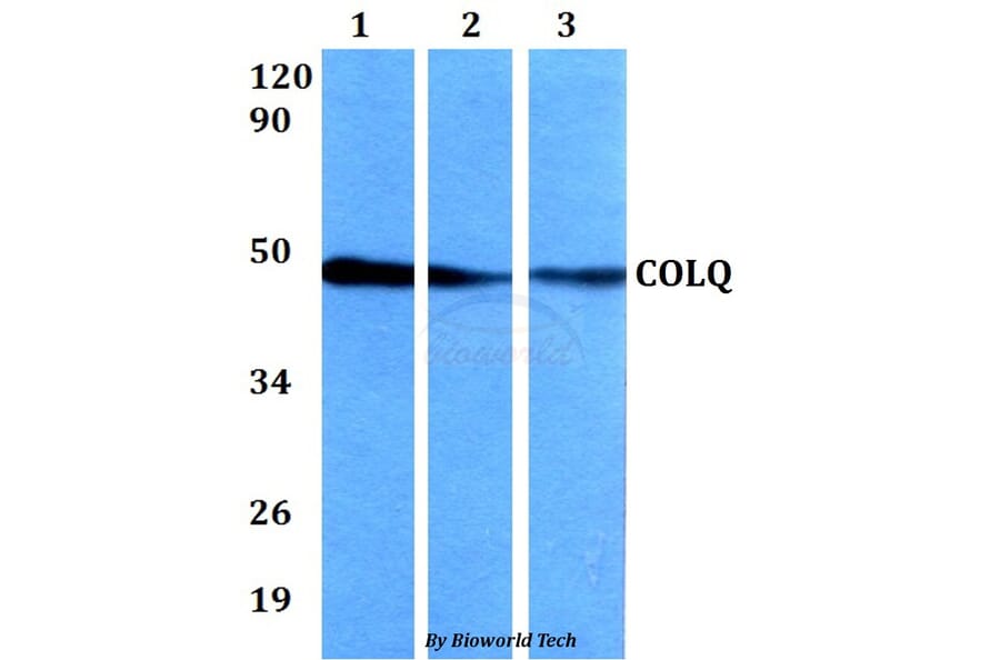Anti-COLQ Antibody from Bioworld Technology (BS60639) - Antibodies.com