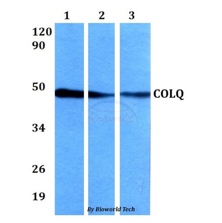 Anti-COLQ Antibody from Bioworld Technology (BS60639) - Antibodies.com