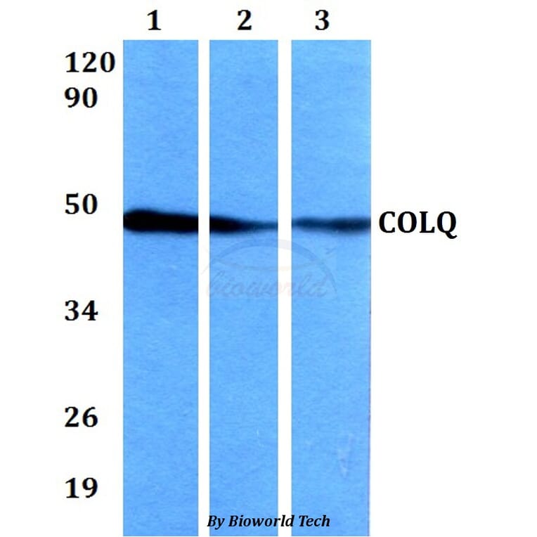 Anti-COLQ Antibody from Bioworld Technology (BS60639) - Antibodies.com