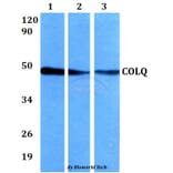 Anti-COLQ Antibody from Bioworld Technology (BS60639) - Antibodies.com