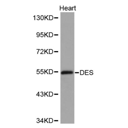 Anti-Desmin Antibody from Bioworld Technology (BS6064) - Antibodies.com