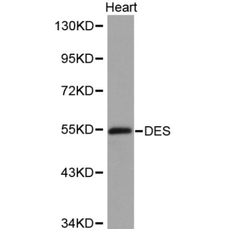Anti-Desmin Antibody from Bioworld Technology (BS6064) - Antibodies.com