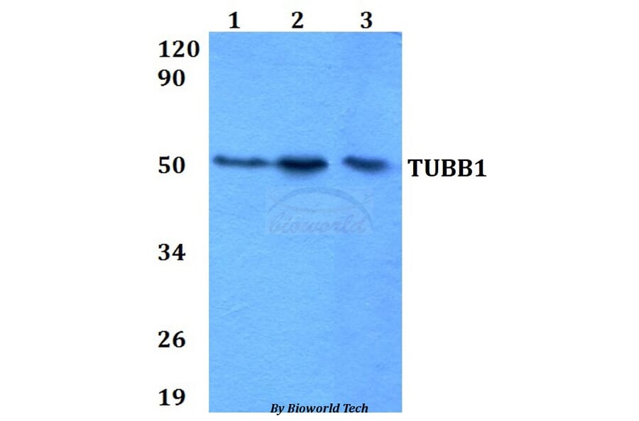 Anti-TUBB1 Antibody from Bioworld Technology (BS60641) - Antibodies.com
