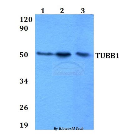 Anti-TUBB1 Antibody from Bioworld Technology (BS60641) - Antibodies.com