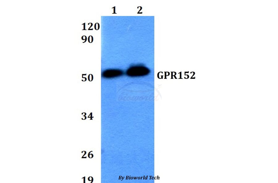 Anti-GPR152 Antibody from Bioworld Technology (BS60644) - Antibodies.com