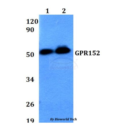 Anti-GPR152 Antibody from Bioworld Technology (BS60644) - Antibodies.com