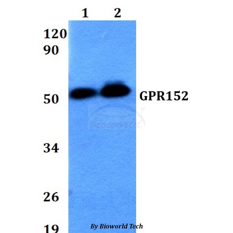 Anti-GPR152 Antibody from Bioworld Technology (BS60644) - Antibodies.com