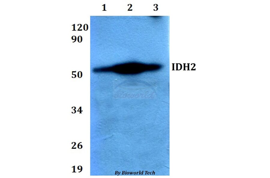 Anti-IDH2 Antibody from Bioworld Technology (BS60645) - Antibodies.com