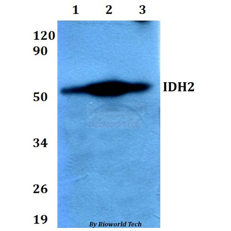 Anti-IDH2 Antibody from Bioworld Technology (BS60645) - Antibodies.com