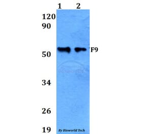 Anti-F9 Antibody from Bioworld Technology (BS60648) - Antibodies.com