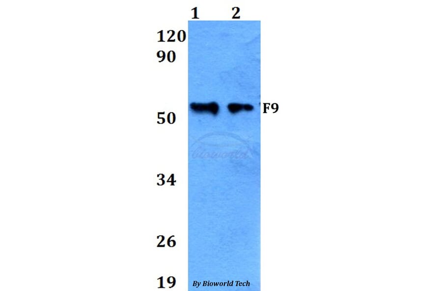 Anti-F9 Antibody from Bioworld Technology (BS60648) - Antibodies.com
