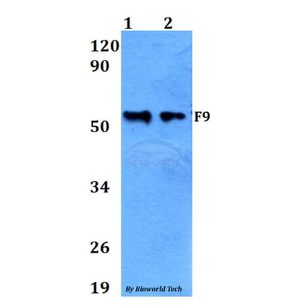 Anti-F9 Antibody from Bioworld Technology (BS60648) - Antibodies.com