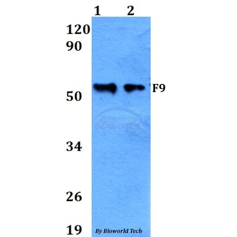 Anti-F9 Antibody from Bioworld Technology (BS60648) - Antibodies.com