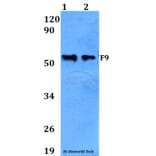 Anti-F9 Antibody from Bioworld Technology (BS60648) - Antibodies.com
