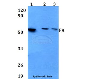 Anti-F9 Antibody from Bioworld Technology (BS60649) - Antibodies.com