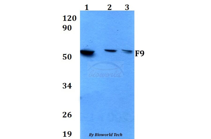 Anti-F9 Antibody from Bioworld Technology (BS60649) - Antibodies.com