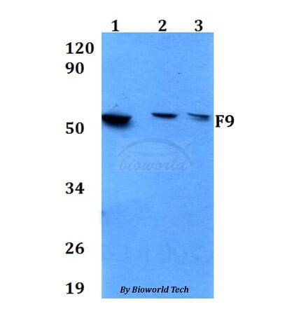 Anti-F9 Antibody from Bioworld Technology (BS60649) - Antibodies.com