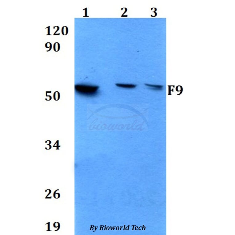 Anti-F9 Antibody from Bioworld Technology (BS60649) - Antibodies.com