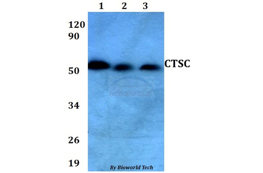 Anti-CTSC Antibody from Bioworld Technology (BS60650) - Antibodies.com