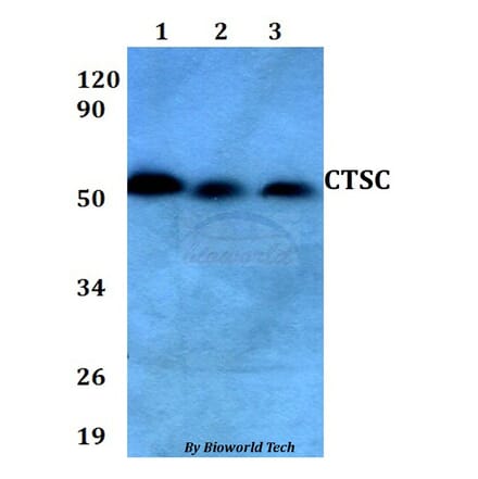 Anti-CTSC Antibody from Bioworld Technology (BS60650) - Antibodies.com