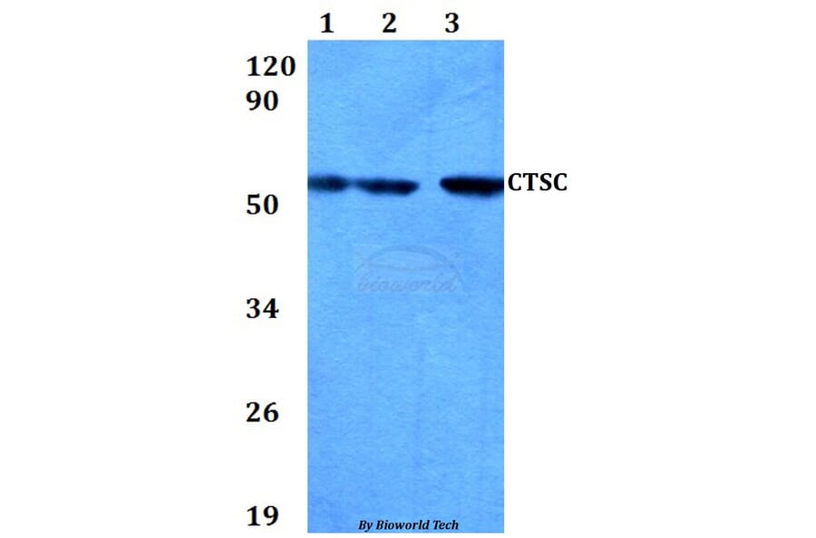 Anti-CTSC Antibody from Bioworld Technology (BS60651) - Antibodies.com