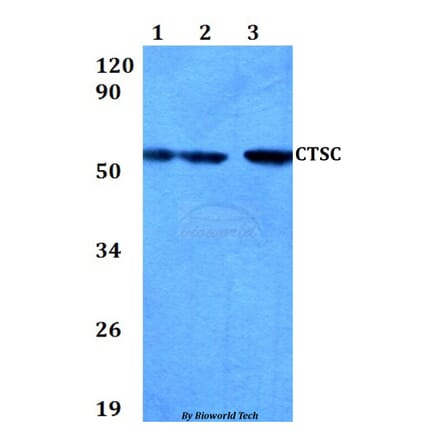 Anti-CTSC Antibody from Bioworld Technology (BS60651) - Antibodies.com