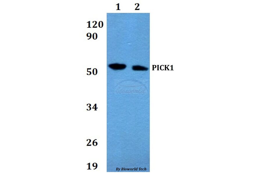 Anti-PICK1 Antibody from Bioworld Technology (BS60653) - Antibodies.com