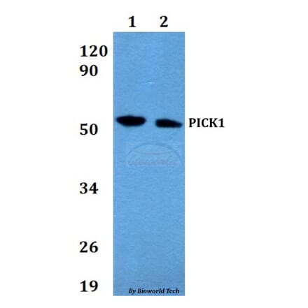 Anti-PICK1 Antibody from Bioworld Technology (BS60653) - Antibodies.com