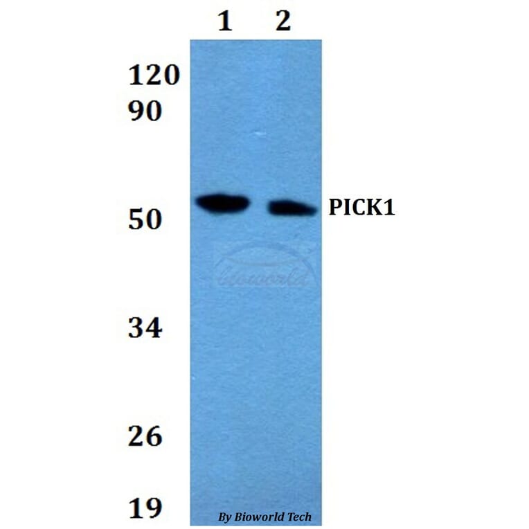 Anti-PICK1 Antibody from Bioworld Technology (BS60653) - Antibodies.com