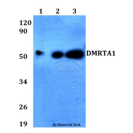 Anti-DMRTA1 Antibody from Bioworld Technology (BS60655) - Antibodies.com