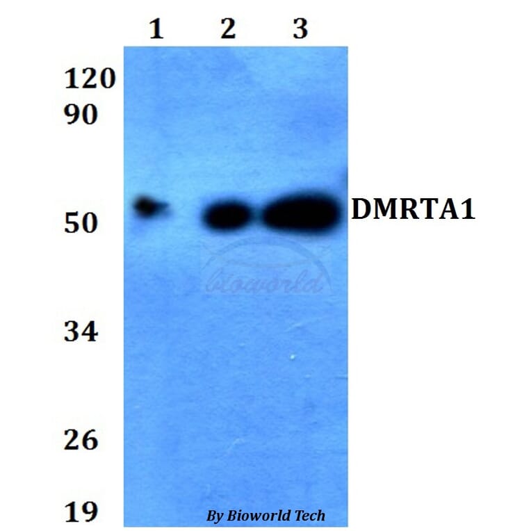 Anti-DMRTA1 Antibody from Bioworld Technology (BS60655) - Antibodies.com