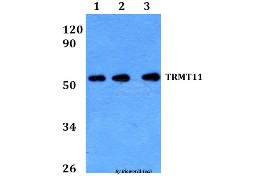 Anti-TRMT11 Antibody from Bioworld Technology (BS60656) - Antibodies.com