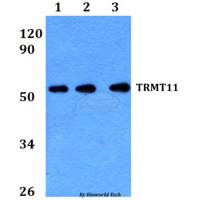 Anti-TRMT11 Antibody from Bioworld Technology (BS60656) - Antibodies.com