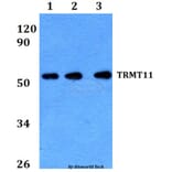 Anti-TRMT11 Antibody from Bioworld Technology (BS60656) - Antibodies.com