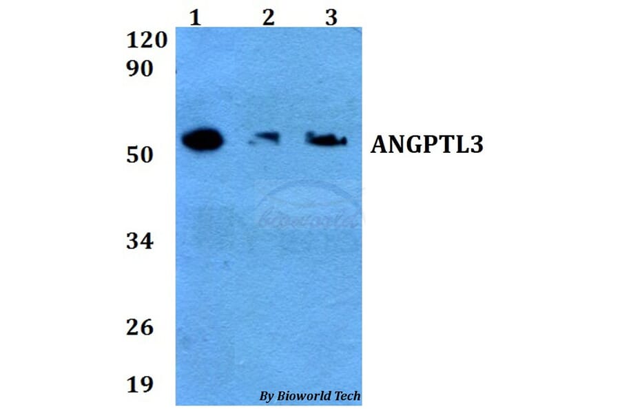 Anti-ANGPTL3 Antibody from Bioworld Technology (BS60658) - Antibodies.com
