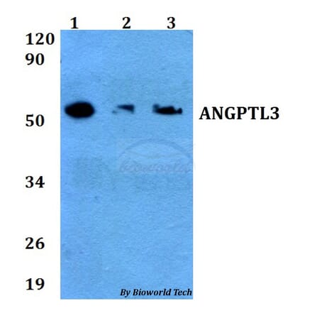 Anti-ANGPTL3 Antibody from Bioworld Technology (BS60658) - Antibodies.com