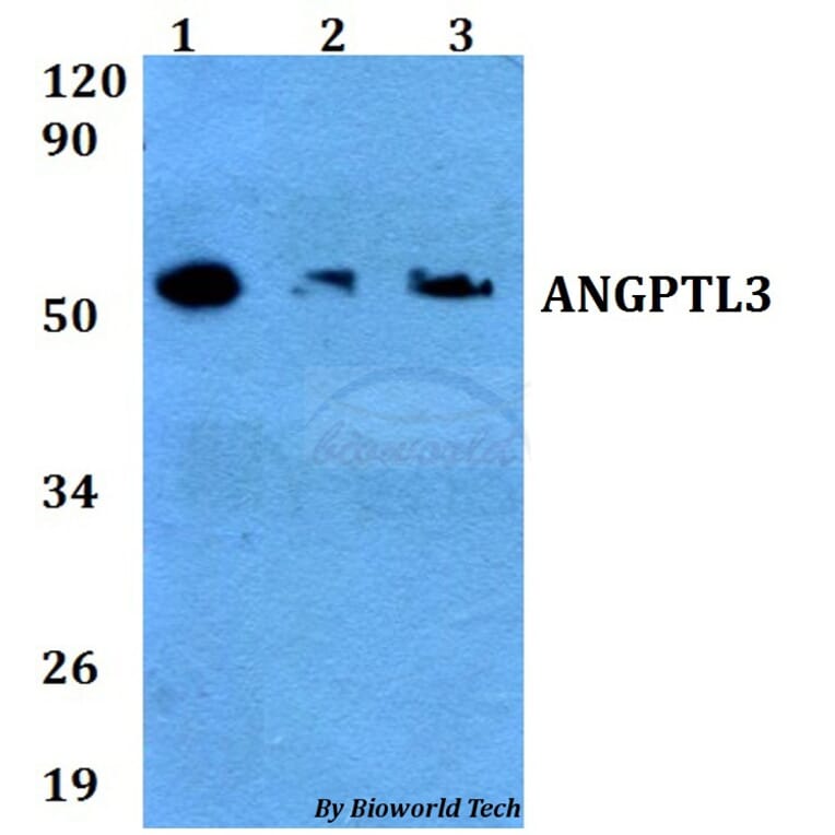 Anti-ANGPTL3 Antibody from Bioworld Technology (BS60658) - Antibodies.com