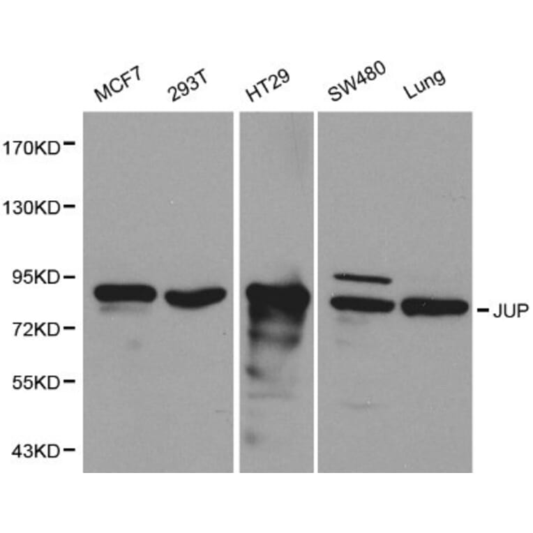 Anti-Catenin-γ Antibody from Bioworld Technology (BS6066) - Antibodies.com