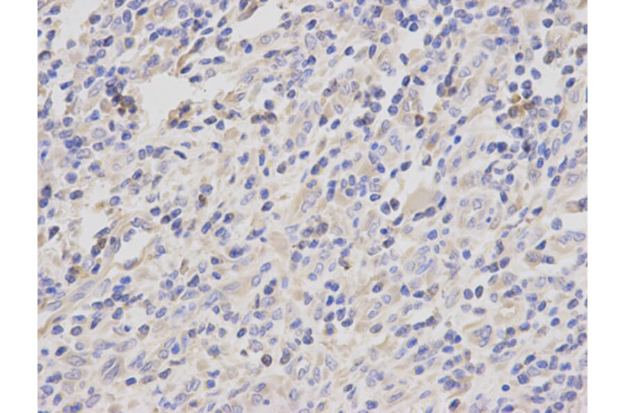 Anti-Catenin-γ Antibody from Bioworld Technology (BS6066) - Antibodies.com