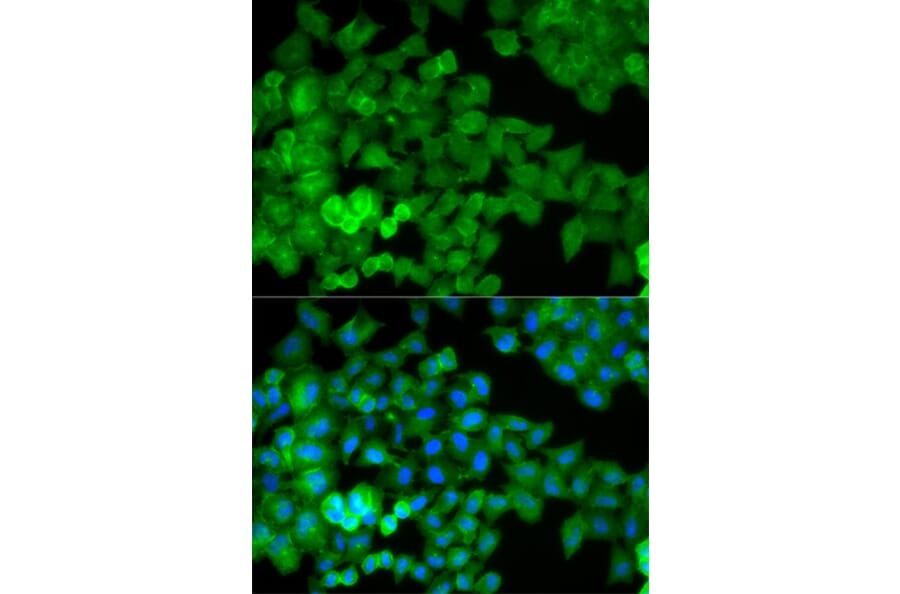 Anti-Catenin-γ Antibody from Bioworld Technology (BS6066) - Antibodies.com