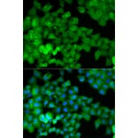 Anti-Catenin-γ Antibody from Bioworld Technology (BS6066) - Antibodies.com