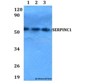 Anti-SERPINC1 Antibody from Bioworld Technology (BS60662) - Antibodies.com