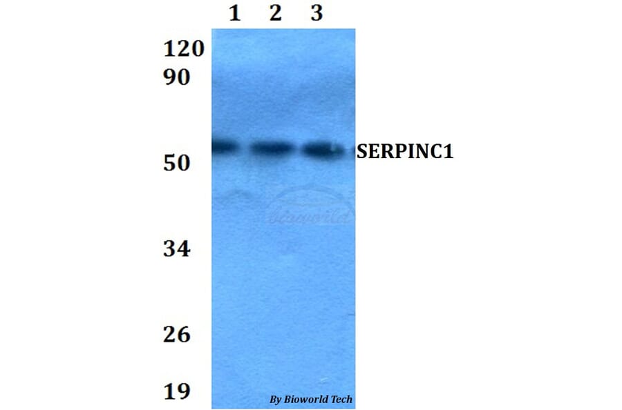 Anti-SERPINC1 Antibody from Bioworld Technology (BS60662) - Antibodies.com