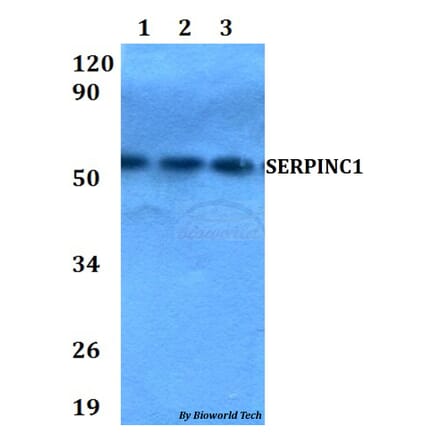 Anti-SERPINC1 Antibody from Bioworld Technology (BS60662) - Antibodies.com